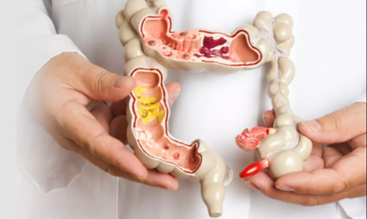 Top 10 Colorectal Surgery Specialists in Rangpur – Expert Colon & Rectal Care - Doctor Rangpur